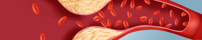 Colesterol e Triglicéridos